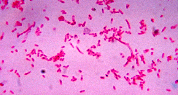 Microscopía de Fusobacterium novum, bacteria de la microbiota vaginal normal