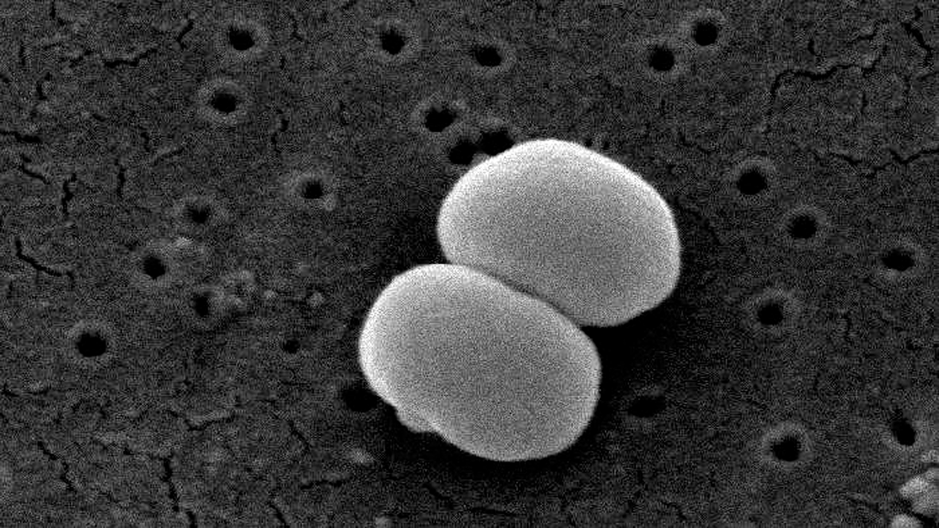 Microscopía electrónica de Staphylococcus epidermidis en la piel humana