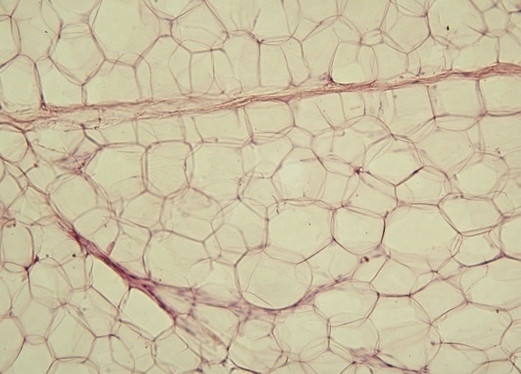 Imagen microscópica de adipocitos, células que almacenan grasa corporal